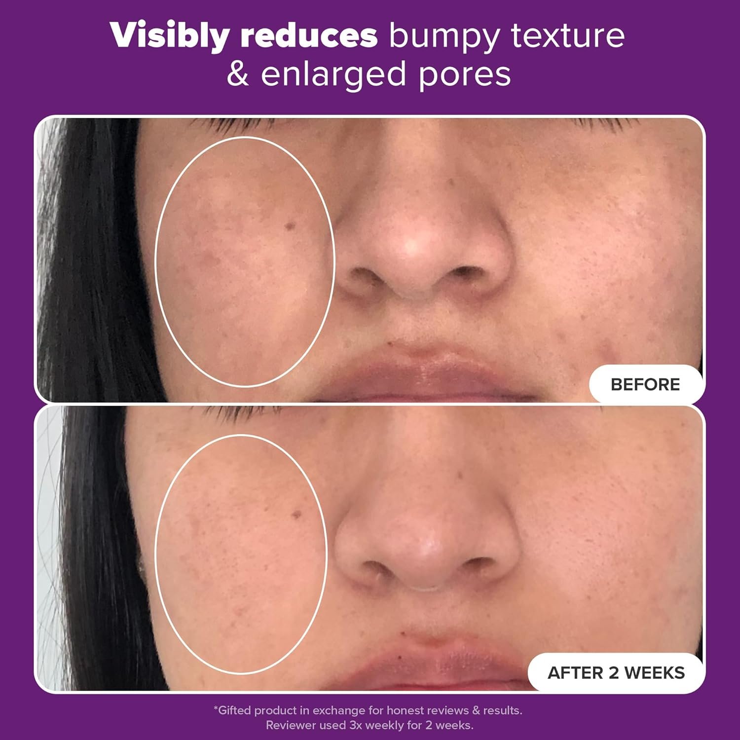 Paula's Choice Clinical 20% Niacinamide Treatment 20ml - Best Treatment for Discoloration & Minimizing Large Pores 5 Paula's Choice Clinical 20% Niacinamide Treatment 20ml - Best Treatment for Discoloration & Minimizing Large Pores - Image 5